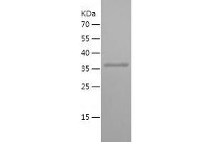 Western Blotting (WB) image for Rab9 Effector Protein with Kelch Motifs (RABEPK) (AA 120-367) protein (His tag) (ABIN7124765) (RABEPK Protein (AA 120-367) (His tag))