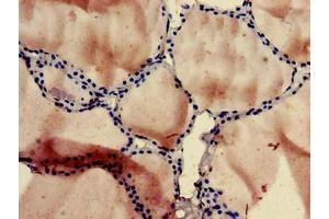 Immunohistochemistry (IHC) image for anti-Solute Carrier Family 1 (Glial High Affinity Glutamate Transporter), Member 3 (SLC1A3) (AA 7-151) antibody (ABIN7162462)