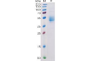 SDS-PAGE (SDS) image for Poliovirus Receptor-Related Immunoglobulin Domain Containing (PVRIG) (AA 1-25), (AA 80-170) protein (Fc Tag) (ABIN6964111)