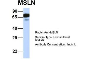 Host:  Rabbit  Target Name:  MSLN  Sample Type:  Human Fetal Muscle  Antibody Dilution:  1. (Mesothelin 抗体  (Middle Region))