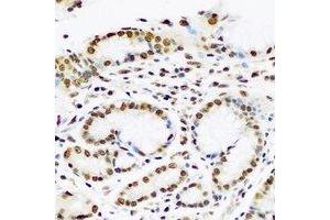 Immunohistochemical analysis of PC4 staining in human stomach formalin fixed paraffin embedded tissue section. (SUB1 抗体)