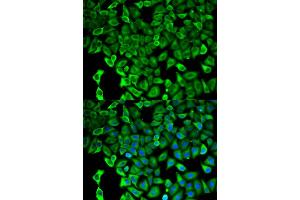 Immunofluorescence analysis of HeLa cells using PSMD2 antibody. (PSMD2 抗体)