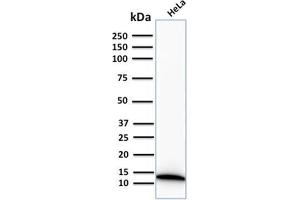 Western Blot Analysis of human HeLa cell lysate using S100A4 Recombinant Rabbit Monoclonal Antibody (S100A4/2750R).