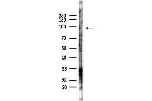 Western blot analysis of lysates from PC12 cells(starvation 24h treatment), using StIp1 Antibody at 1/1000 dilution.