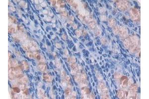 DAB staining on IHC-P; Samples: Mouse Colon Tissue (GMFG 抗体  (AA 12-127))