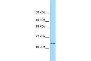 WB Suggested Anti-Dnalc4 Antibody Titration: 1. (DNAL4 抗体  (Middle Region))