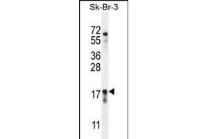 C Antibody (Center) (ABIN655473 and ABIN2844997) western blot analysis in SK-BR-3 cell line lysates (35 μg/lane). (C1ORF115 抗体  (AA 76-104))
