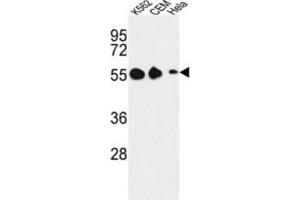 Western Blotting (WB) image for anti-Galanin Receptor 1 (GALR1) antibody (ABIN3004139) (Galanin Receptor 1 抗体)