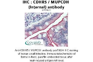 Image no. 1 for anti-Mucin and Cadherin-Like (CDHR5) (Internal Region) antibody (ABIN1732924) (CDHR5 抗体  (Internal Region))