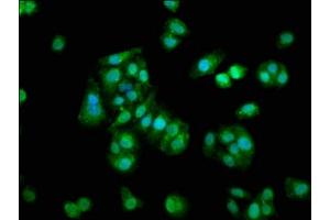 Immunofluorescence staining of HepG2 cells with ABIN7166030 at 1:133, counter-stained with DAPI. (S1A1 (AA 2-94) 抗体)