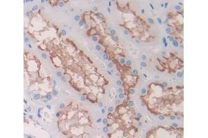 Immunohistochemistry (IHC) image for anti-ATP-Binding Cassette, Sub-Family B (MDR/TAP), Member 7 (ABCB7) (AA 472-752) antibody (ABIN5013186)