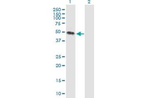 Western Blot analysis of KREMEN2 expression in transfected 293T cell line by KREMEN2 MaxPab polyclonal antibody. (KREMEN2 抗体  (AA 1-420))
