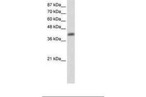 Image no. 2 for anti-Aprataxin (APTX) (C-Term) antibody (ABIN203063) (Aprataxin 抗体  (C-Term))