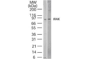 Image no. 1 for anti-Interleukin-1 Receptor-Associated Kinase 1 (IRAK1) (AA 700-712) antibody (ABIN208558) (IRAK1 抗体  (AA 700-712))