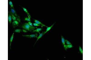 Immunofluorescence staining of Hela cells with ABIN7157178 at 1:100, counter-stained with DAPI. (Junctophilin 1 抗体  (AA 431-546))