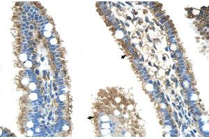 Immunohistochemistry (IHC) image for anti-Aldehyde Dehydrogenase 4 Family, Member A1 (ALDH4A1) (N-Term) antibody (ABIN2782323)