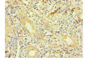 Immunohistochemistry of paraffin-embedded human kidney tissue using ABIN7150804 at dilution of 1:100 (Dynactin 1 抗体  (AA 1084-1278))