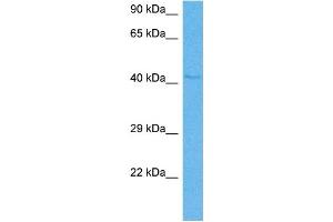 Host:  Mouse  Target Name:  IHH  Sample Tissue:  Mouse Heart  Antibody Dilution:  1ug/ml (Indian Hedgehog 抗体  (N-Term))