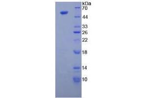 SDS-PAGE analysis of Human Tubulin beta 3 Protein. (TUBB3 蛋白)