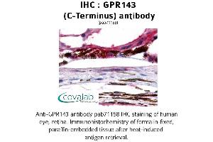 Image no. 1 for anti-G Protein-Coupled Receptor 143 (GPR143) (C-Term) antibody (ABIN1734946) (GPR143 抗体  (C-Term))
