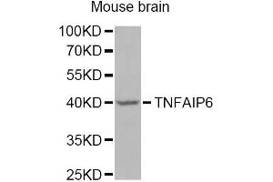Western blot analysis of extracts of mouse brain, using TNFAIP6 Antibody.
