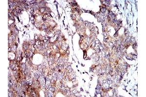 Immunohistochemistry (IHC) image for anti-BCL2/adenovirus E1B 19kDa Interacting Protein 3 (BNIP3) (AA 50-155) antibody (ABIN5858883) (BNIP3 抗体  (AA 50-155))
