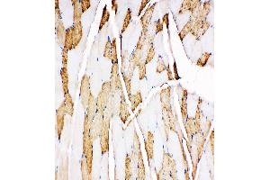 Anti-Myoglobin antibody, IHC(P) IHC(P): Rat Skeletal Muscle Tissue (Myoglobin 抗体  (C-Term))