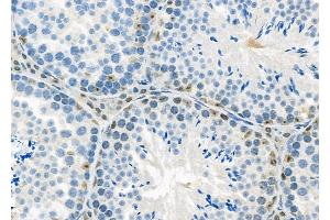 ABIN6263540 and ABIN6279810 at 1/100 staining Mouse testis tissue by IHC-P. (NCKIPSD 抗体  (Internal Region))
