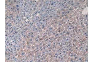 IHC-P analysis of Mouse Liver Tissue, with DAB staining. (IL-2 抗体  (AA 10-169))