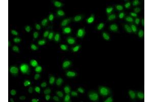 Immunofluorescence analysis of A549 cell using SULT2B1 antibody. (SULT2B1 抗体)