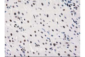 Immunohistochemical staining of paraffin-embedded Human Ovary tissue using anti-MEF2C mouse monoclonal antibody. (MEF2C 抗体)