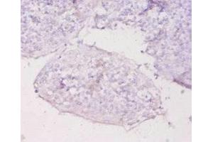 Immunohistochemistry of paraffin-embedded human tonsil tissue using ABIN7159517 at dilution of 1:20 (MT1E 抗体  (AA 4-59))