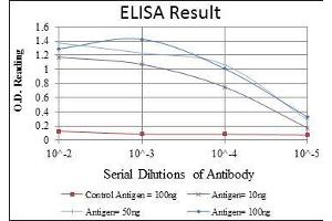 Red: Control Antigen (100 ng), Purple: Antigen (10 ng), Green: Antigen (50 ng), Blue: Antigen (100 ng), (FOXP2 抗体)