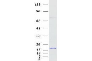Western Blotting (WB) image for Ribosomal Protein S24 (RPS24) (Transcript Variant A) protein (Myc-DYKDDDDK Tag) (ABIN2731168)
