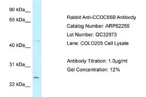 Western Blotting (WB) image for anti-Coiled-Coil Domain Containing 85B (CCDC85B) (N-Term) antibody (ABIN2789085) (CCDC85B 抗体  (N-Term))