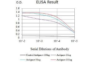 Black line: Control Antigen (100 ng),Purple line: Antigen (10 ng), Blue line: Antigen (50 ng), Red line:Antigen (100 ng) (SOX11 抗体  (AA 1-250))