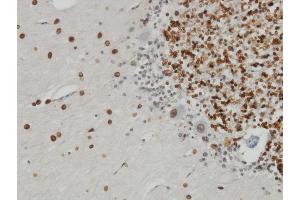 Immunoperoxidase of monoclonal antibody to TPR on formalin-fixed paraffin-embedded human cerebellum. (TPR 抗体  (AA 1-98))