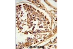 Formalin-fixed and paraffin-embedded human testis tissue reacted with LIPE Antibody (C-term) (ABIN653323 and ABIN2842814) , which was peroxidase-conjugated to the secondary antibody, followed by DAB staining. (LIPE 抗体  (C-Term))