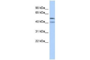 Western Blot showing ZNF566 antibody used at a concentration of 1-2 ug/ml to detect its target protein. (ZNF566 抗体  (Middle Region))