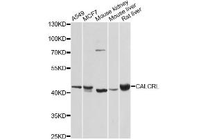 Western blot analysis of extracts of various cell lines, using CALCRL antibody. (CALCRL 抗体)