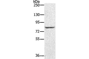 Western blot analysis of Jurkat cell, using RNF43 Polyclonal Antibody at dilution of 1:300 (RNF43 抗体)