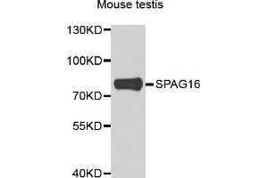 Western blot analysis of extracts of mouse testis, using SPAG16 antibody. (SPAG16 抗体)