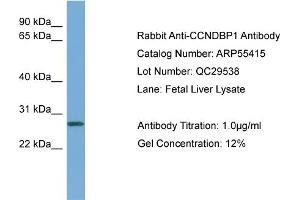 WB Suggested Anti-CCNDBP1  Antibody Titration: 0. (CCNDBP1 抗体  (Middle Region))