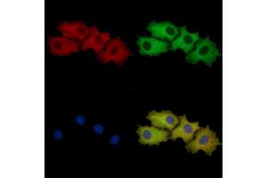 YTHDF1 Mouse Monoclonal Antibody staining HepG2 cells by IF/ICC. (YTHDF1 抗体  (N-Term))