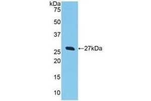 Detection of Recombinant GSTa2, Human using Polyclonal Antibody to Glutathione S Transferase Alpha 2 (GSTa2) (GSTa2 抗体  (AA 1-222))