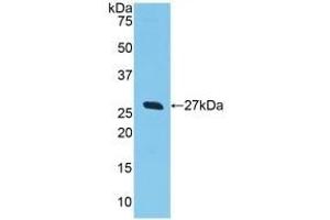 Detection of Recombinant GSTa2, Human using Polyclonal Antibody to Glutathione S Transferase Alpha 2 (GSTa2)
