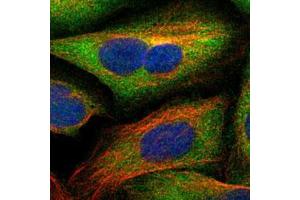Immunofluorescent staining of U-2 OS cells with SCRN1 polyclonal antibody  (Green) shows localization to cytosol. (Secernin 1 抗体)