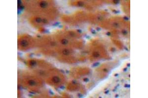 Used in DAB staining on fromalin fixed paraffin-embedded Liver tissue (AGT 抗体  (AA 23-477))