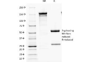 SDS-PAGE Analysis Purified PTH Mouse Monoclonal Antibody (PTH/1173). (PTH 抗体  (AA 32-115))
