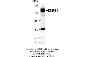 Image no. 6 for anti-Scavenger Receptor Class B, Member 1 (SCARB1) (AA 450-509), (C-Term) antibody (ABIN363399) (SCARB1 抗体  (C-Term))